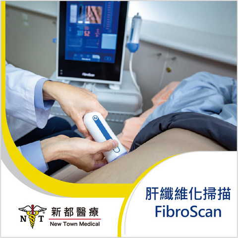 FibroScan®肝纖維化掃描 - 超前預防肝臟疾病